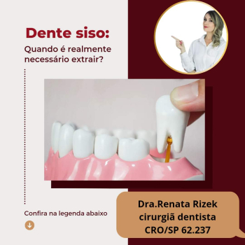 Dente do Siso:Quando é necessário extrair?